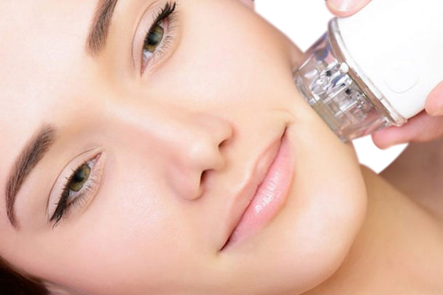 Gutschein RF Microneedling