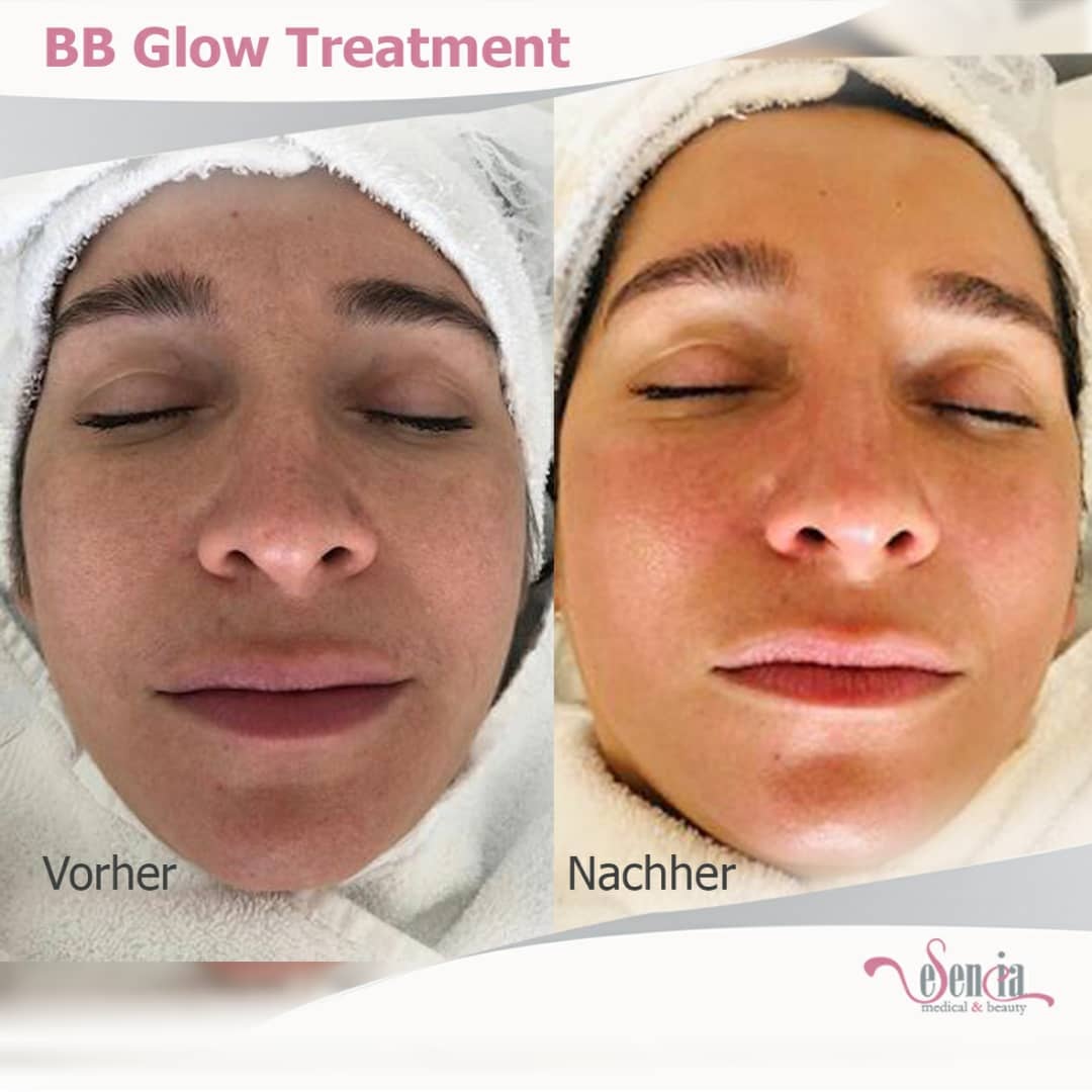 BB Glow – eSenCia